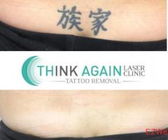Think Again Laser Clinic – Auckland
