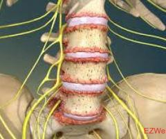 Back Pain Treatment Toronto
